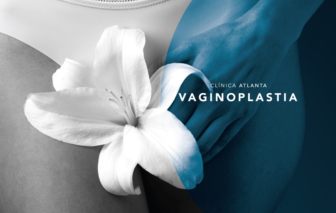 Vaginoplastia Clínica Atlanta 0664